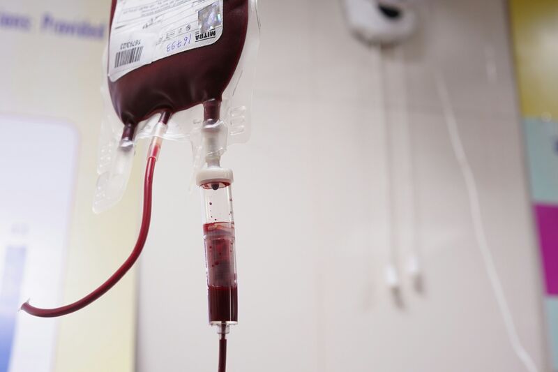 A bag of blood with a drip chamber and tubing hanging from a stand in a clinical setting.